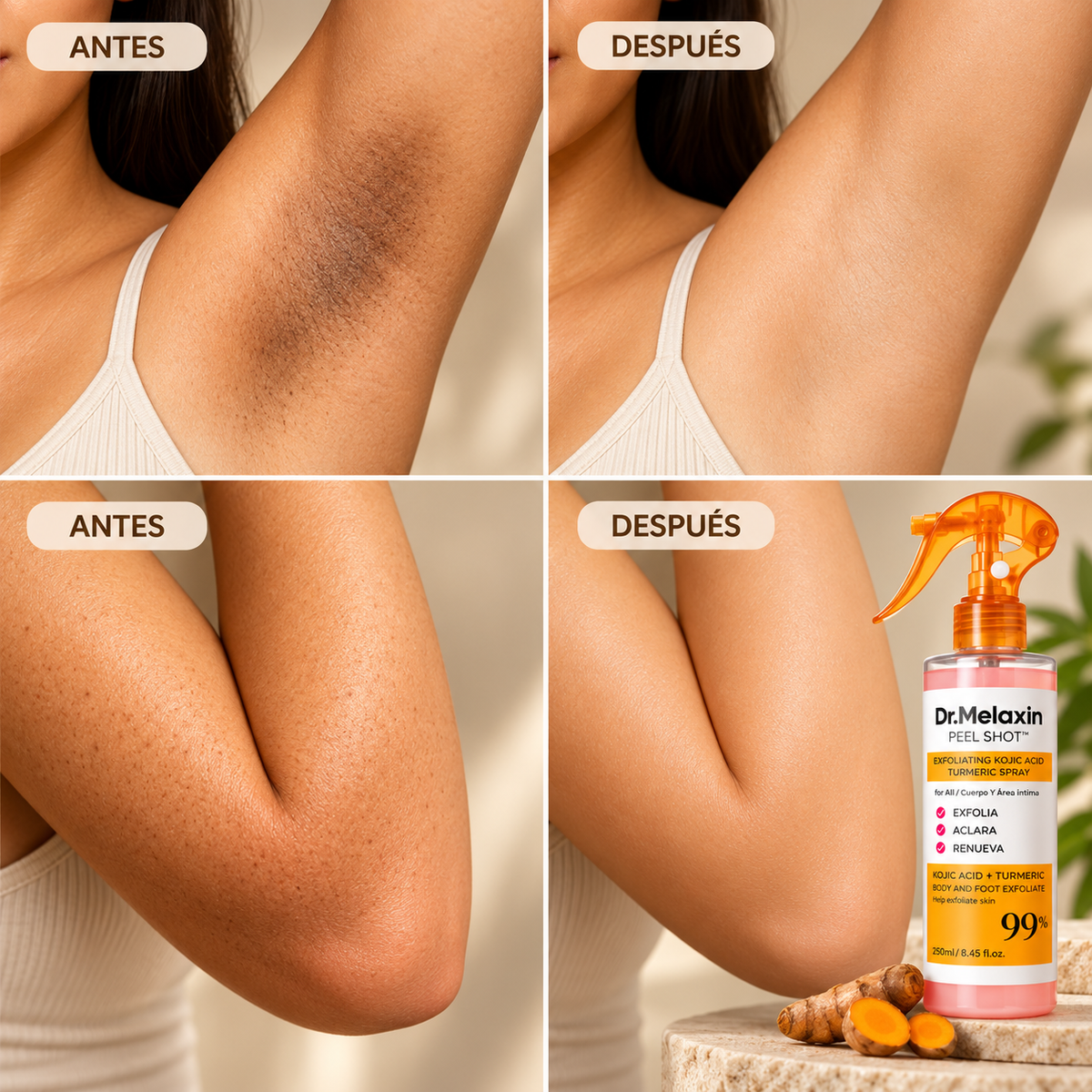 Velmora™ – Spray exfoliante corporal con ácido kójico