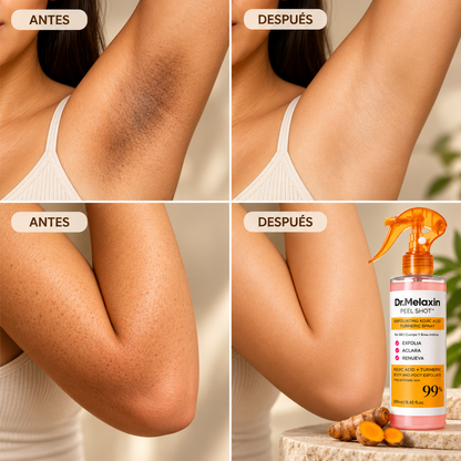 Velmora™ – Spray exfoliante corporal con ácido kójico